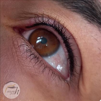 میکروبلیدینگ فرزانه قلعه  میکروبلیدینگ فرزانه قلعه