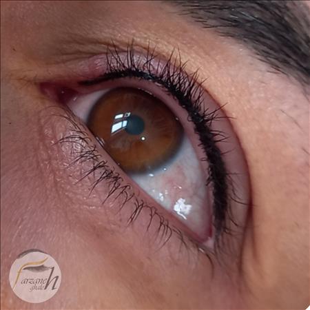 میکروبلیدینگ فرزانه قلعه