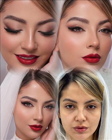 زیبایی شیدا ابراهیمی