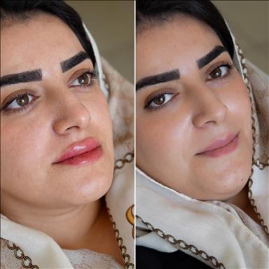 کلینیک ماهک  11