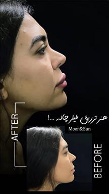 کلینیک پوست و مو ماه و خورشید در کرج