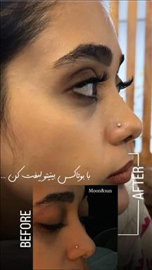 کلینیک پوست و مو ماه و خورشید 1