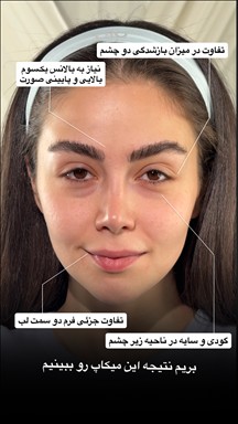 زیبایی آرزو شاندیزی