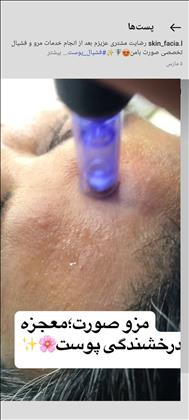  پاک سازی و فیشال عرب پور