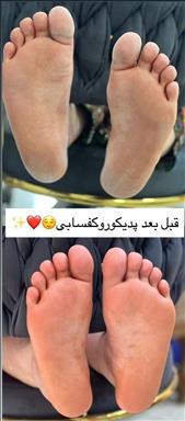 زیبایی زرطلا 1