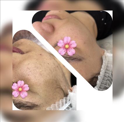 فیشال فائقه حبیبی