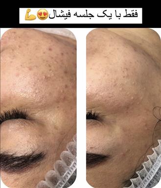 فیشال فائقه حبیبی آمل