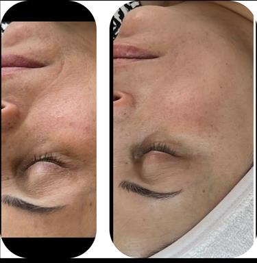 فیشال فائقه حبیبی 1