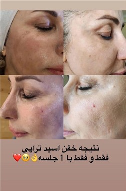 گریم عروس