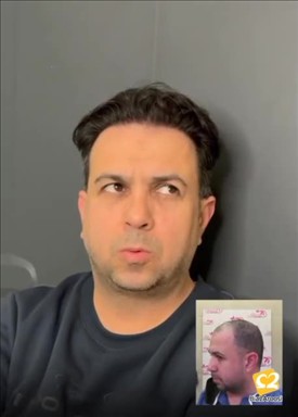کلینیک تخصصی پوست و مو باران توس 3