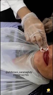 مرکز تخصصی فیبروز ابرو و میکروپیگمنتیشن سارا 1