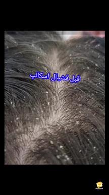 پنجه ی آفتاب