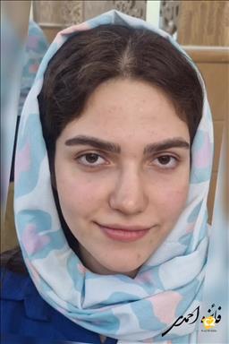 زیبایی شهربانو احمدی